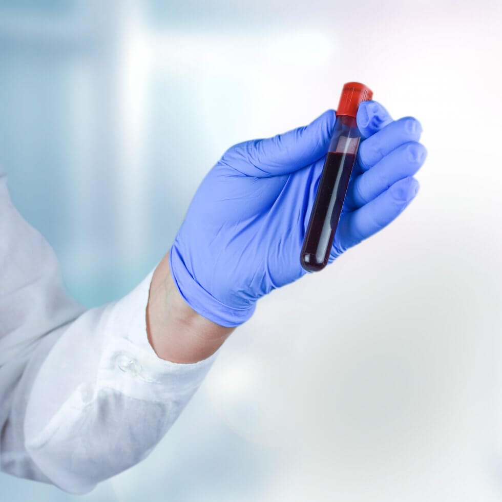 cord_blood_leukaemia_treatment-980x980-1.jpg