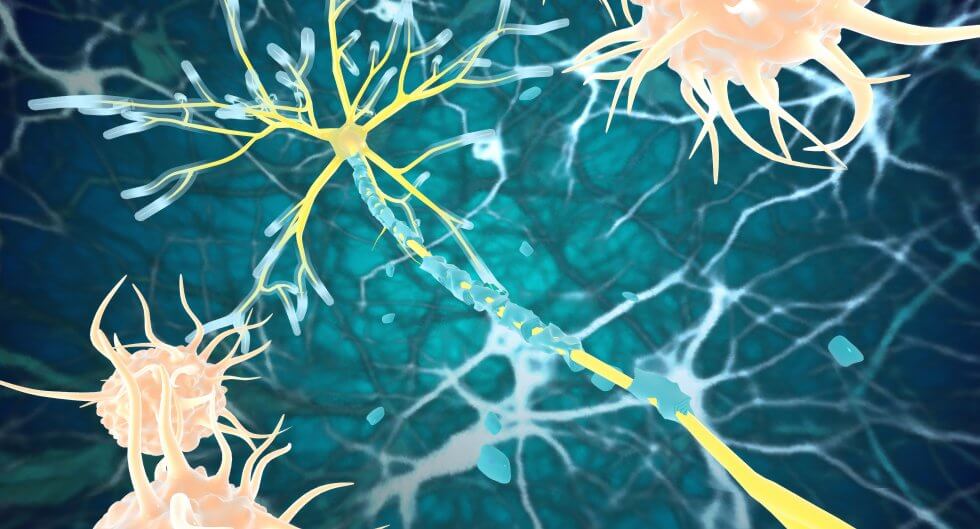 multiple-sclerosis-neurons-980x529-1.jpg